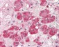 NT5E / eNT / CD73 Antibody (aa27-252, clone 2B6)